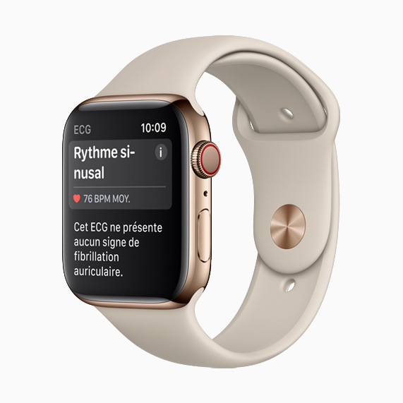 Apple Watch Series 4 montrant un rythme sinusal.