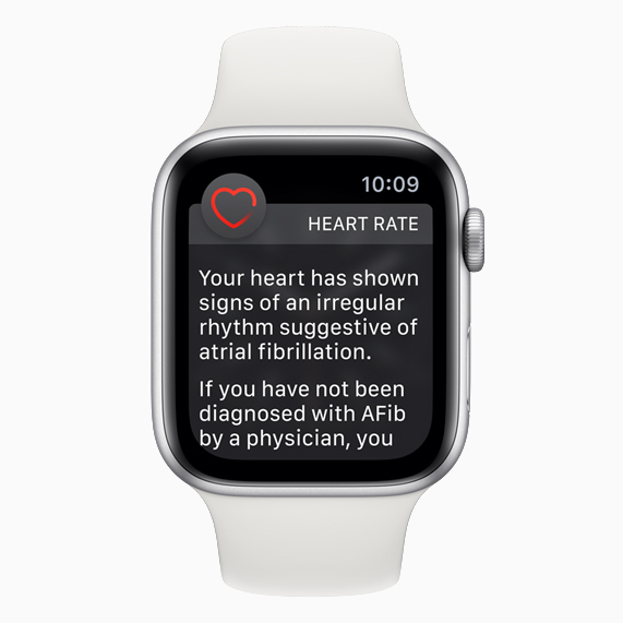 Apple Watch face with irregular heart rhythm notification.