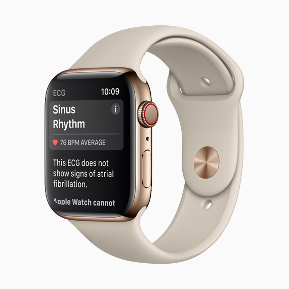 Apple Watch Series 4 showing sinus rhythm.