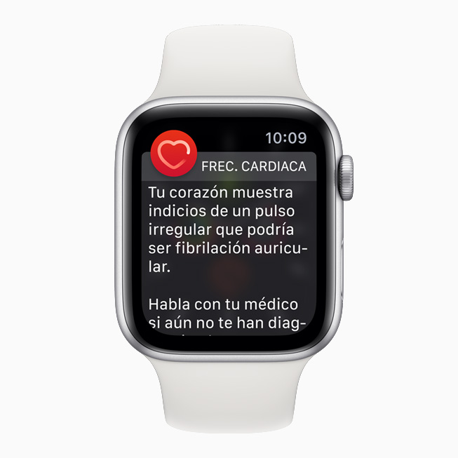 La notificación de ritmo sinusal en la app ECG del Apple Watch. 