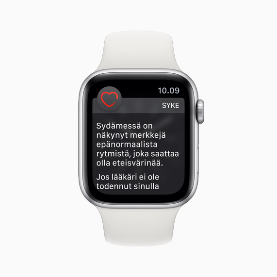 Apple Watch face with irregular heart rhythm notification.