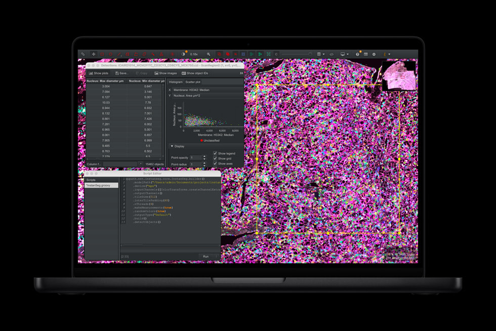 MacBook Pro shows a QuPath screen.