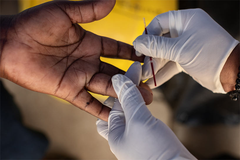 A sterilized needle is used to prick the finger for a blood sample.