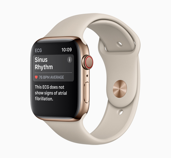 Apple Watch with Sinus Rhythm screen.