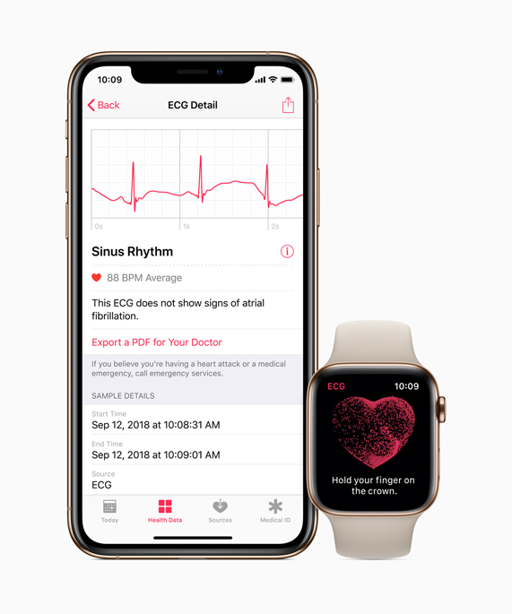 Irregular Rhythm Notification