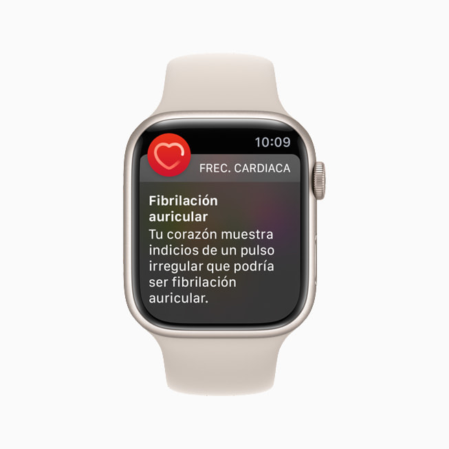 Notificación de fibrilación auricular de la app ECG en el Apple Watch Series 7.