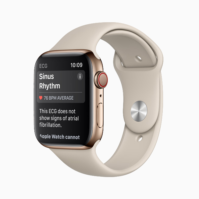 Sinus Rhythm notification displayed in the ECG app on Apple Watch. 