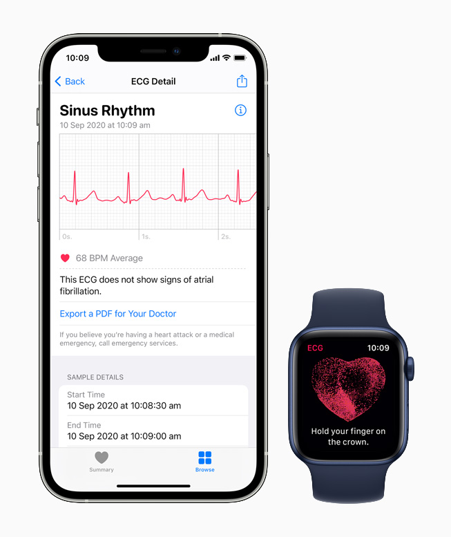 The ECG app displaying the sinus rhythm classification on Apple Watch Series 6 and iPhone 12 Pro.