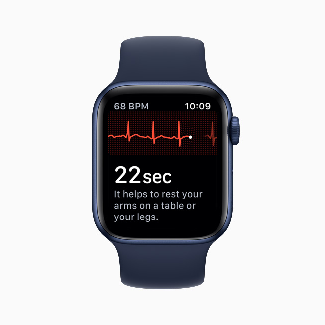 The ECG app interface on Apple Watch Series 6.