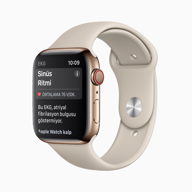 Apple Watch’taki EKG uygulamasında gösterilen Sinüs Ritmi bildirimi. 